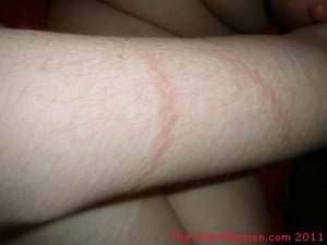 Rope Marks